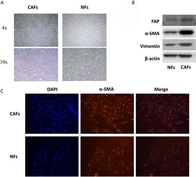 LncRNA FENDRR in Carcinoma-Associated Fibroblasts Regulates the Angiogenesis of Oral Squamous Cell Carcinoma Through the PI3K/AKT Pathway